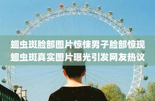 蛔虫斑脸部图片惊悚男子脸部惊现蛔虫斑真实图片曝光引发网友热议